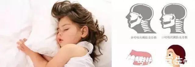 畸形|父母請注意：孩子12歲之前必須矯正的幾種牙齒畸形