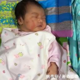 宝宝|宝宝一个月了，脸上的产钳印还没消，婆婆的一句抱怨让妈妈火了