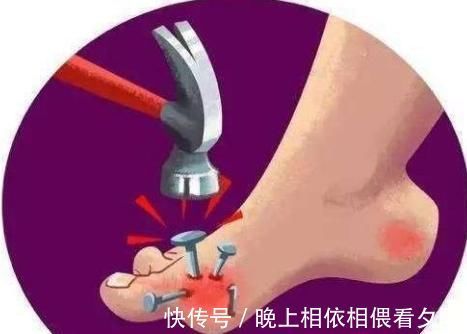 碱性食物|痛风“凶手”终于找到了,不怪喝汤喝酒,5事少做点,尿酸嗖嗖降