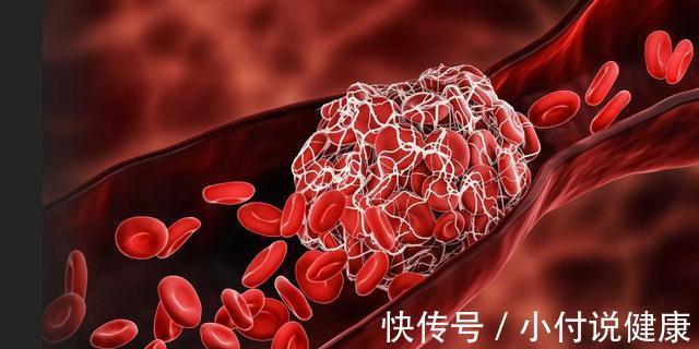 肥肉|为什么医生不建议常吃肉呢?提醒:这5种肉,能少吃就少吃