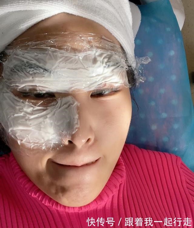 黄金微针 号称“小热玛吉”的黄金微针你了解吗!