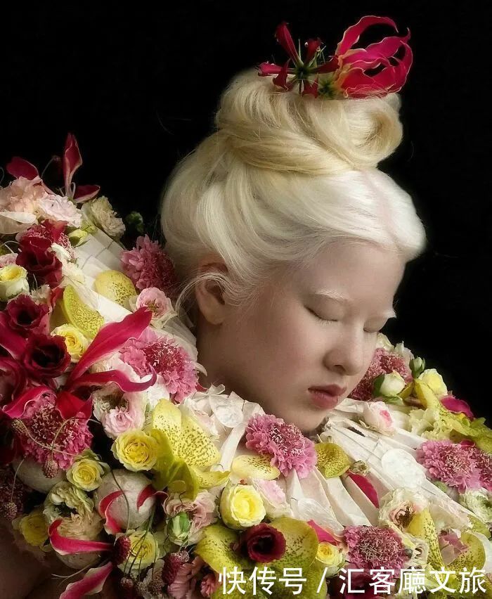 逆袭|因“全身雪白”被遗弃的中国女孩,逆袭成超模的故事让人泪目