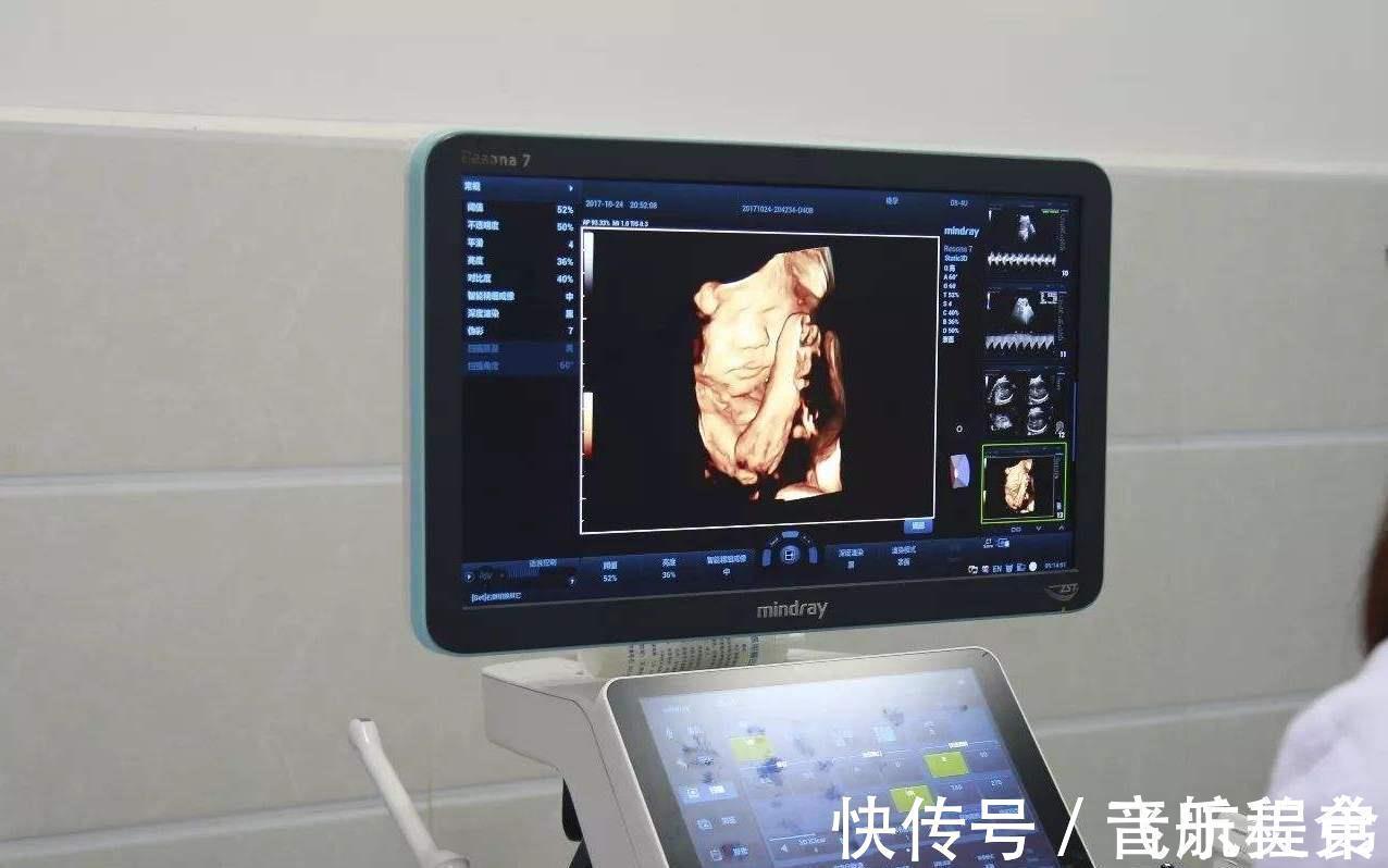 四维彩超|怀“小王子”的宝妈,身上有这4大特征,赶快接好孕吧