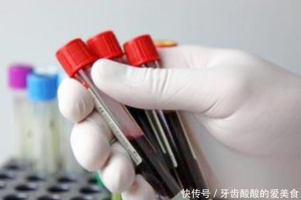 妈妈|一个孕期下来,孕妇要抽多少管“血”?过来人:血管都“干瘪”了