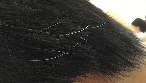 求救信号|大病来临前,头上会发出“求救信号”,越早发现越好,别不重视