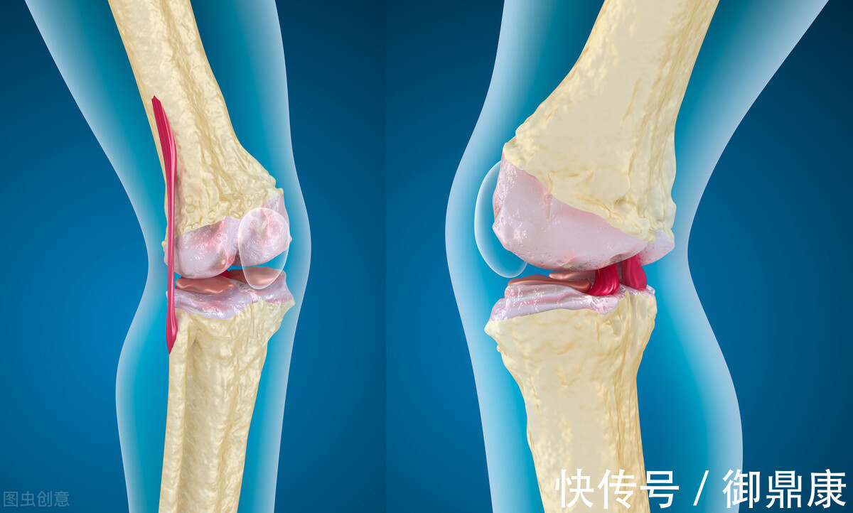 草酸|这3种素菜比可乐还伤骨,建议少吃!保护骨骼要从吃开始