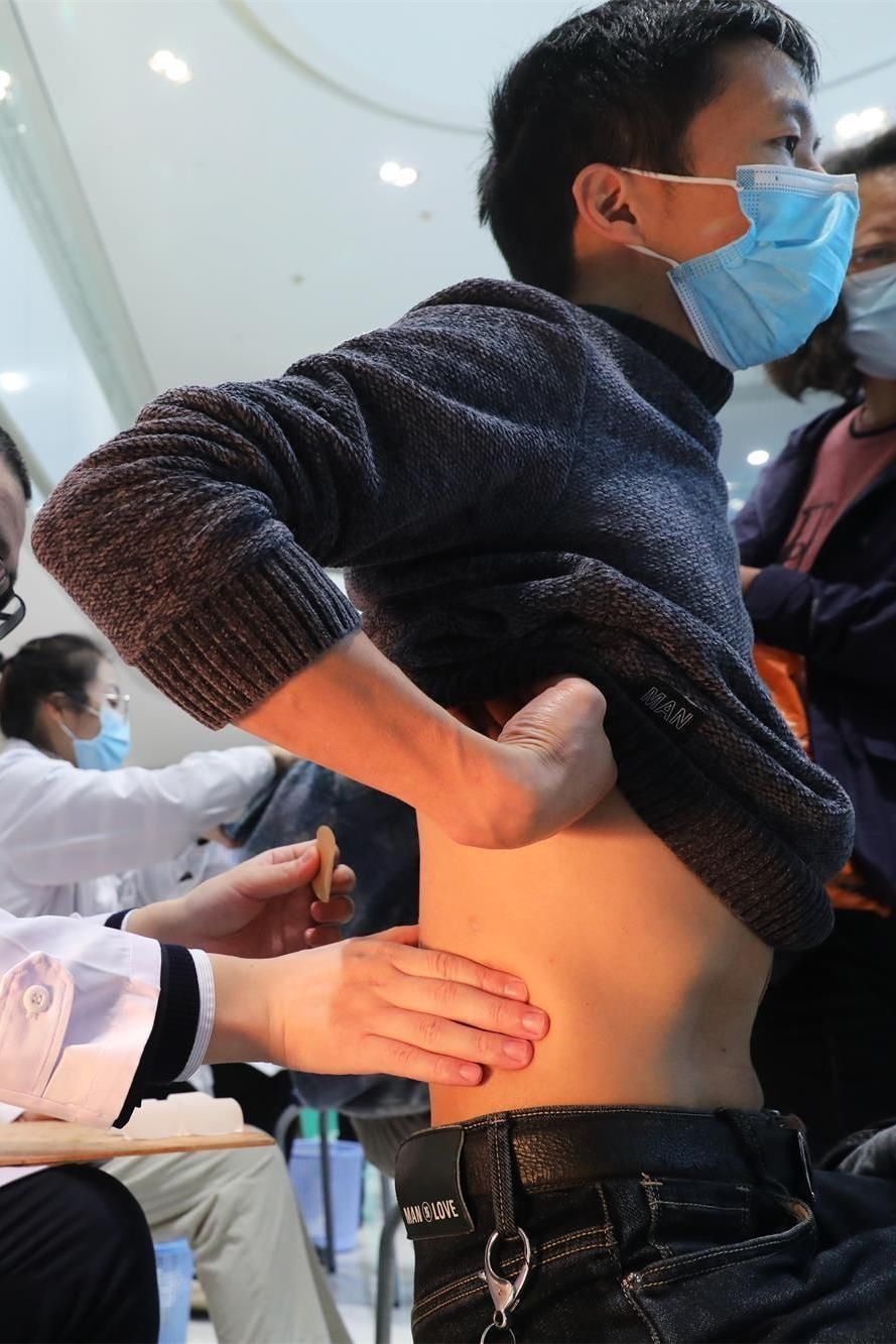 疗效|冬至养生有讲究!并非所有人都适合三九天灸