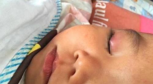 睿智|4岁儿子误将502滴进眼睛,妈妈一个举动挽救孩子,医生:睿智