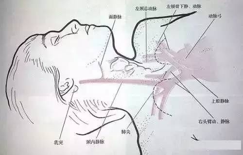 乳突肌|? 手把手教你颈内静脉穿刺术！（收藏版）