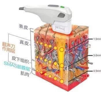 折纹|你的脖子比脸更显老，出现颈纹该怎么去除？丨科普篇