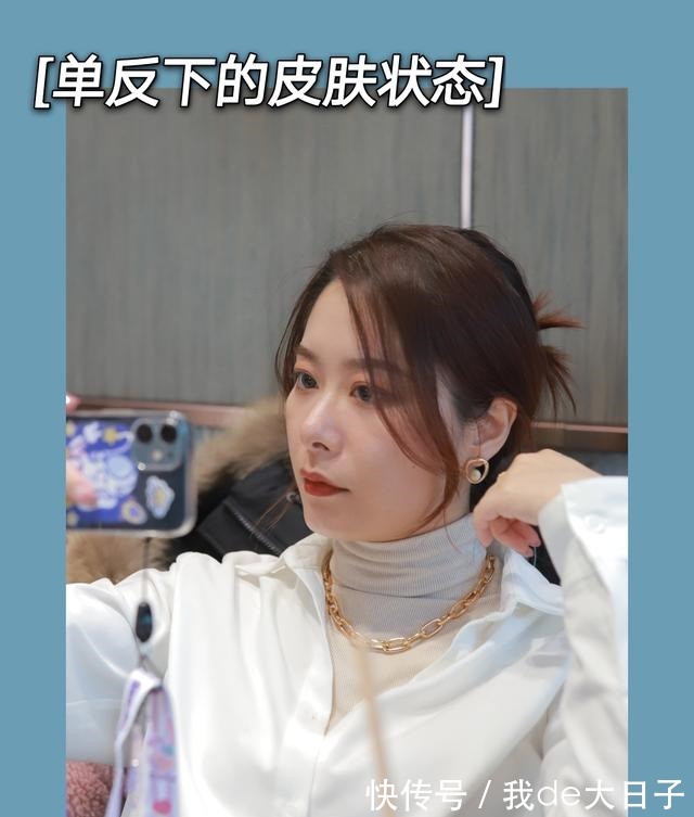 光子嫩肤 6次光子嫩肤后,我的脸怎么样了!