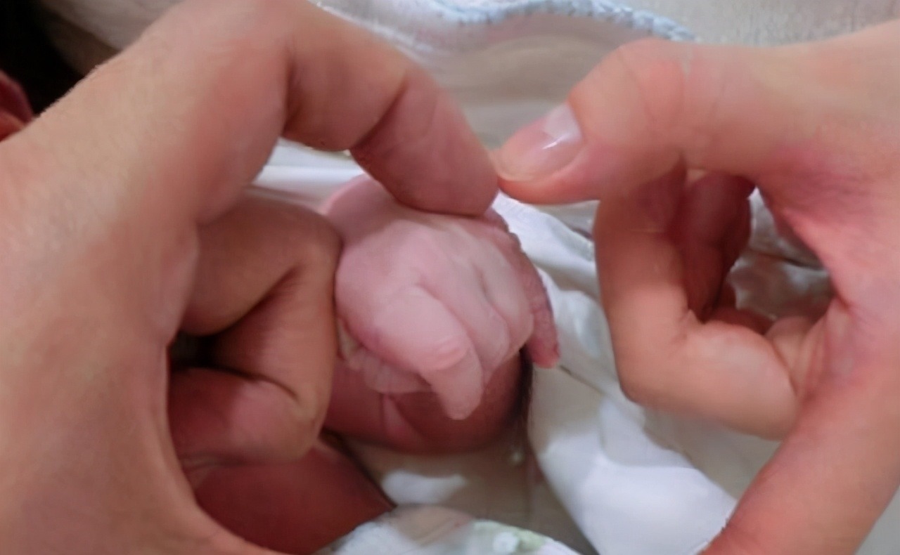 急产|产妇刚进产房就生了,娃“呱唧”一声落地,医护当场愣住:这么快!