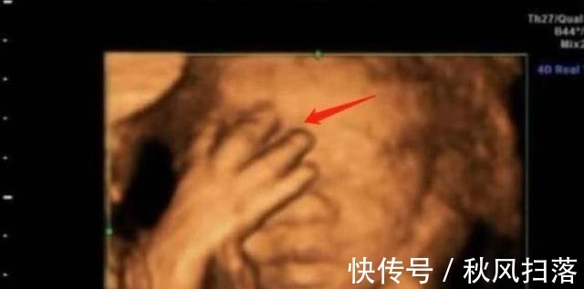 算数|“天才”胎儿走红,还在妈妈肚里就会“算数”,医生清华北大等你