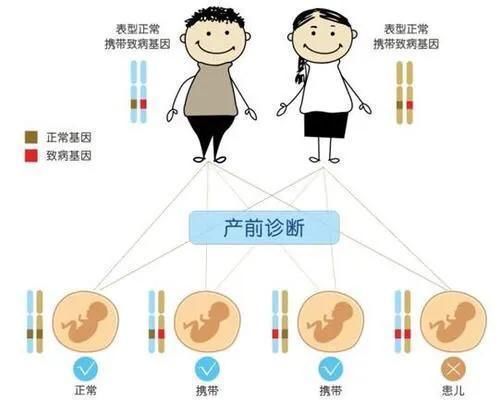 产前诊断|专题科普：怀孕那些事（六）