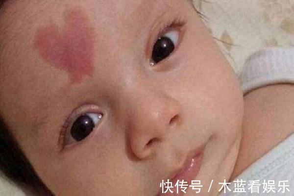 宝宝|孕妇在孕期这两个事情要注意,会让胎儿长胎记,很多孕妇忽略了