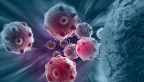 名单|九种癌症“候选人”名单出炉！有些人最易得癌症！有你吗