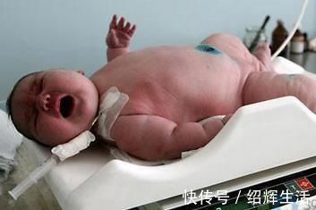 孕期|怀孕后,为何有的人不显怀,有的肚子却很大?