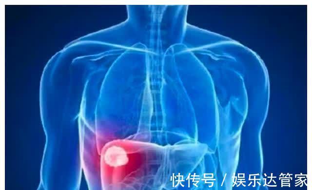 胆囊息肉|胆囊息肉你知多少?这时候了解,还不算晚