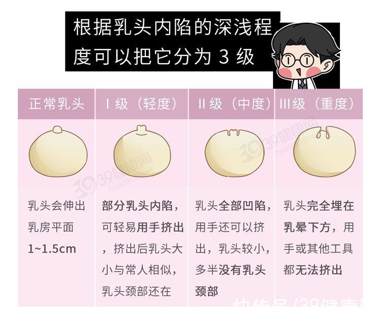 乳房|什么是“乳头内陷”？要怎么治疗？2个原因，可能让它暂时消失