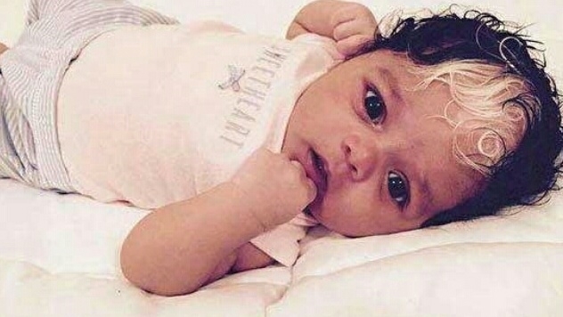 白毛|女婴生下来头上有一撮白毛，医生嘲笑，宝妈却乐坏了