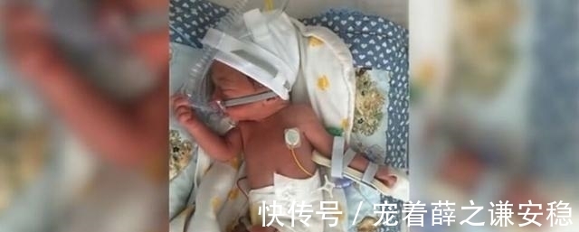 胎儿|腹中胎儿对镜头挥手,其实是求救讯号,医生脸色大变进行紧急手术