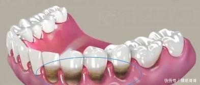 中药|关于有中药成分的牙膏,最近很多对话是酱样子的——