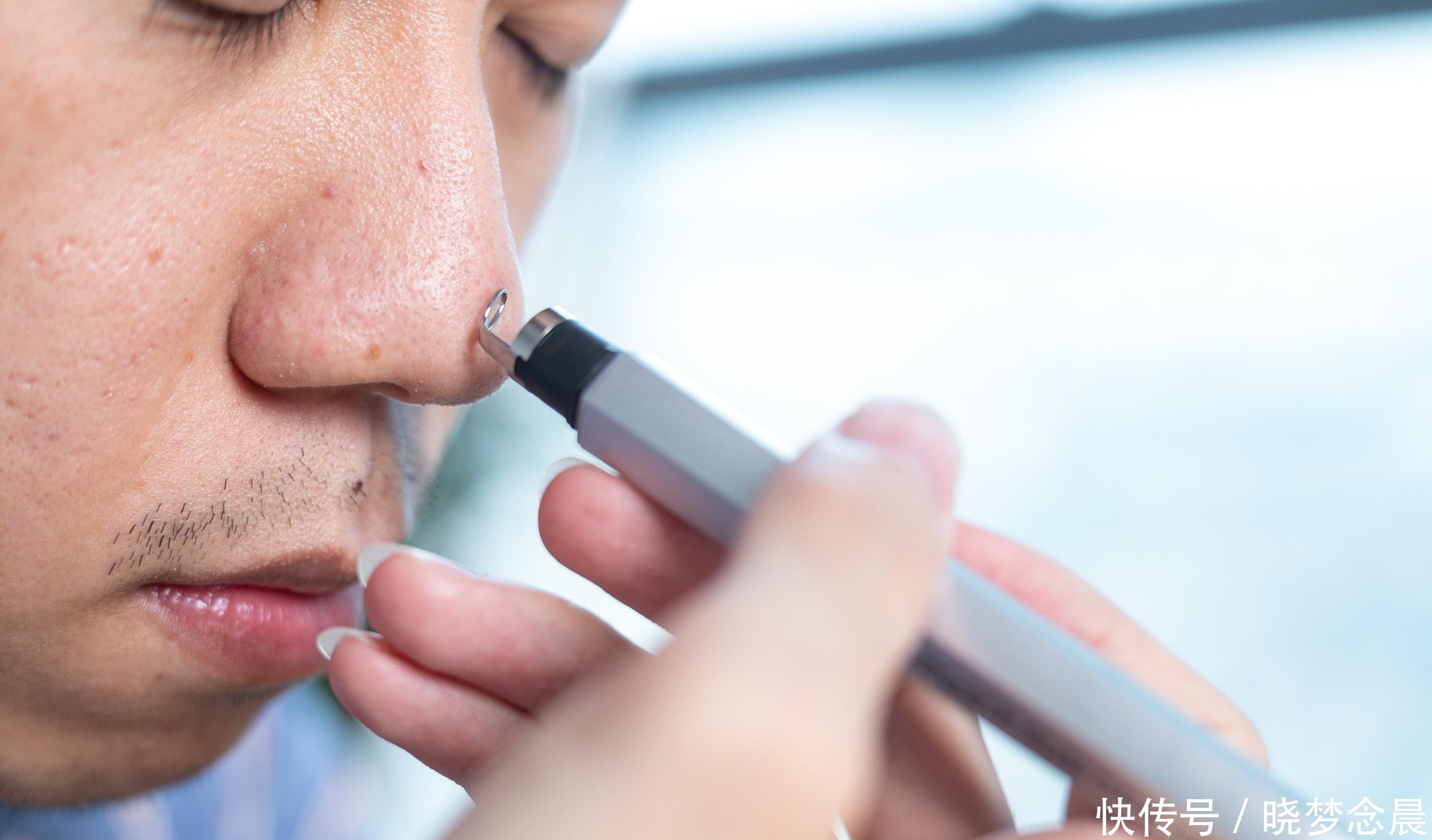 小米有品“脸部吸尘器”要火!陈年“老泥”被掏空,比北方搓澡爽