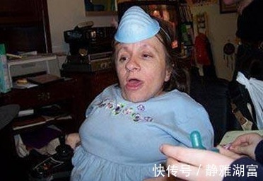 美国身高70厘米的袖珍妈妈,身体肿如气球,如今俩孩子