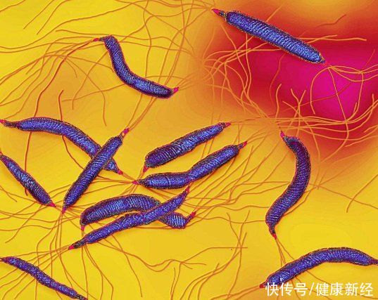 致癌物|不想感染幽门螺杆菌,就要远离这3种不良习惯,胃不难受