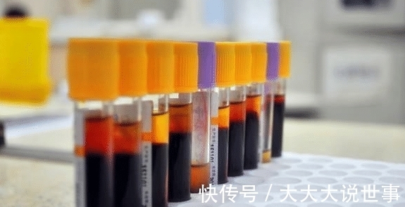 诊断|血常规能查出癌症吗？医生：“揪出”早期癌症，不要放过这3项