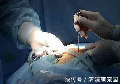 胃癌|为什么说“富人得肠癌,穷人得胃癌”?分别要注意什么?说清楚了