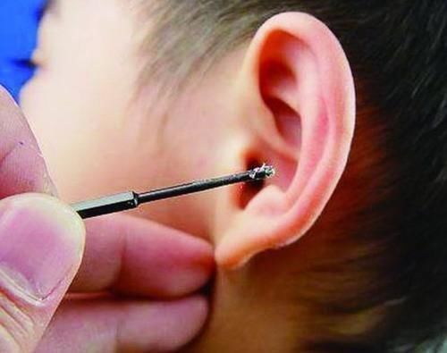 医院|4岁女儿总要妈妈帮挖耳朵,但也挖不出东西,去了医院才真相大白