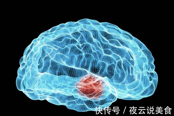 脑中风|医生忠告不想被中风缠上,晚上坚持“2多3不要”,中风远离你