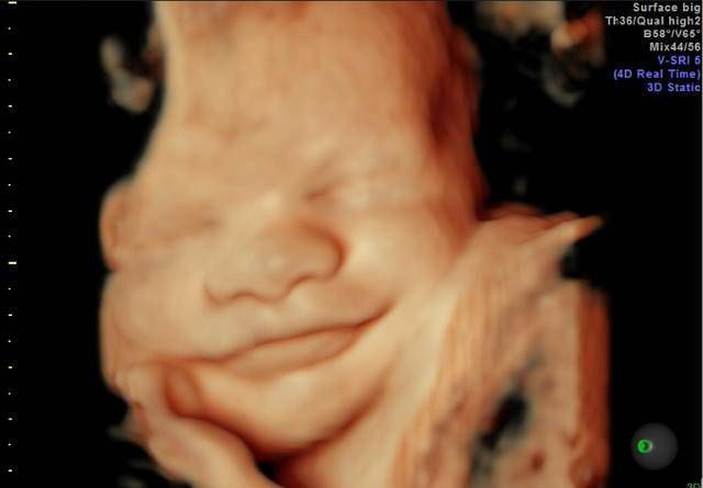 为什么有些医院做四维彩超不让家属陪同这些原因，大家有权知道