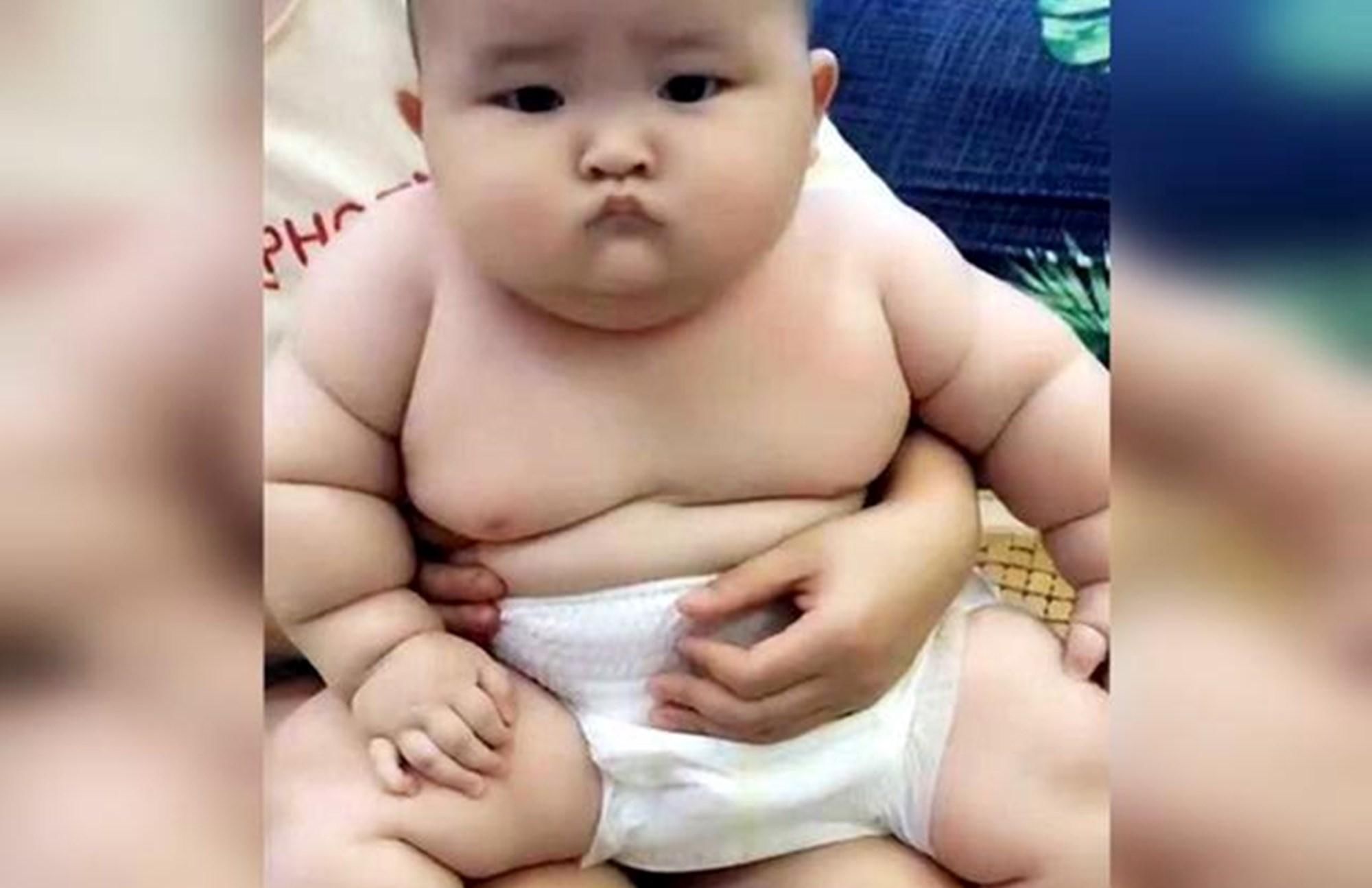 母乳|1岁宝宝体重30斤,被母乳“催熟”到浑身肉坨,医生别沾沾自喜