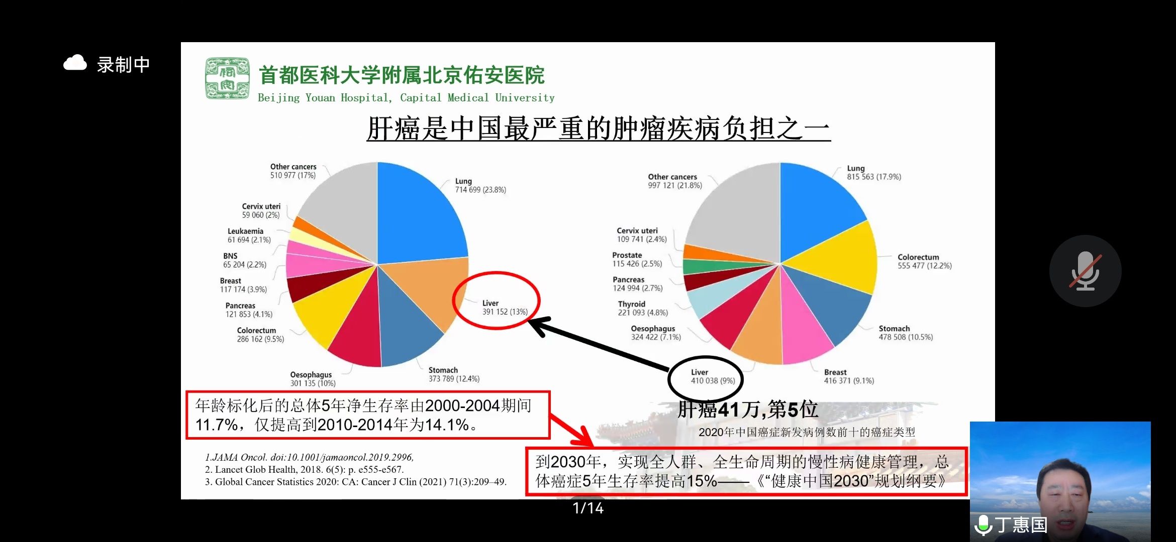 原发性肝癌|丁惠国教授《原发性肝癌高危人群的分层筛查与监测：临床实践》