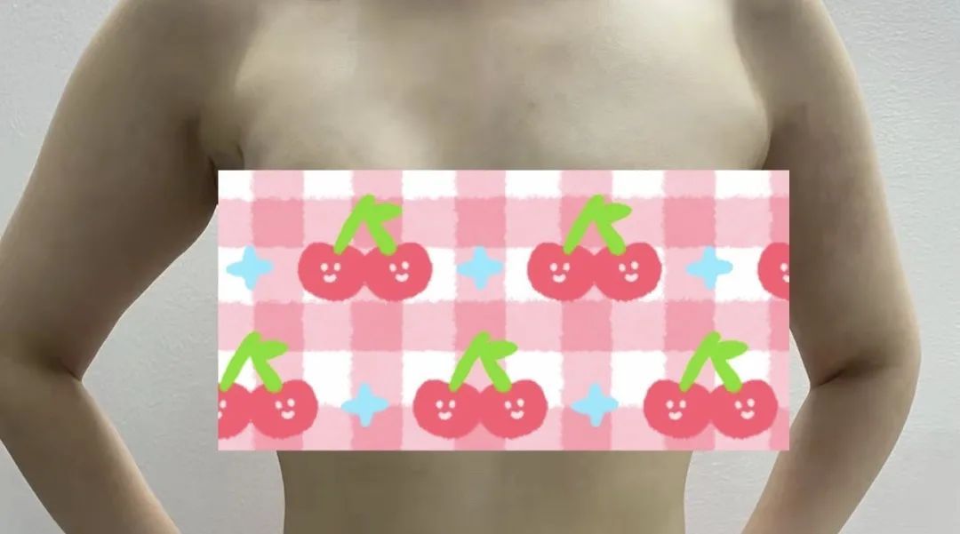 黄建|29岁患乳腺癌，这种手术方式居然找不到疤痕？健康美丽一步到位！