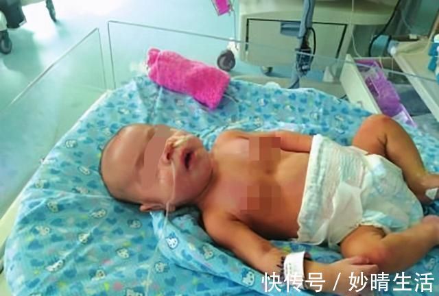 女婴|五个月女婴双肾长满结石,只因刚出生三天,父母就开始做这件事
