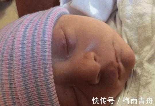 怀胎|女子怀胎九个多月后才知道已有身孕,知道消息一小时后便产子!