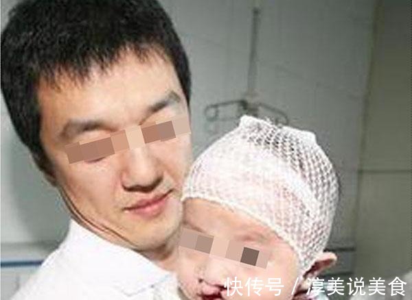 孕妇|医生三类孕妇容易生“兔唇”宝宝,如果你在其中,就要小心了