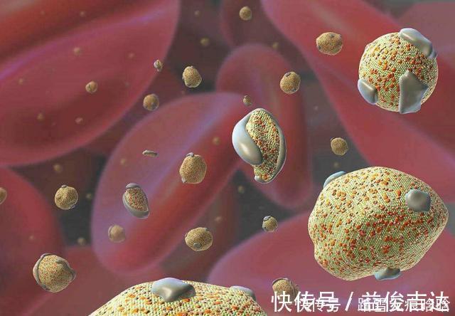 心脑血管|低密度脂蛋白高，教你一日三餐这样吃，血脂降下来，血管畅通