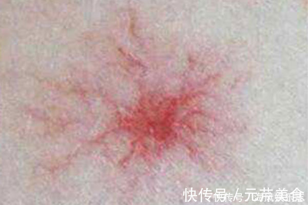 脸上有张“疾病地图”,哪里生病了,它会“告诉你”,快对照自检