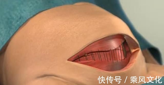 分娩|宝妈吐槽分娩时的尴尬:头胎顺产被“剃毛”,二胎剖腹产也没逃掉