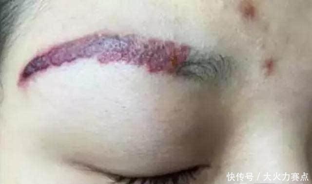 眉毛|为什么不建议女生纹眉内行人说出“底细”，看完再做决定也不晚