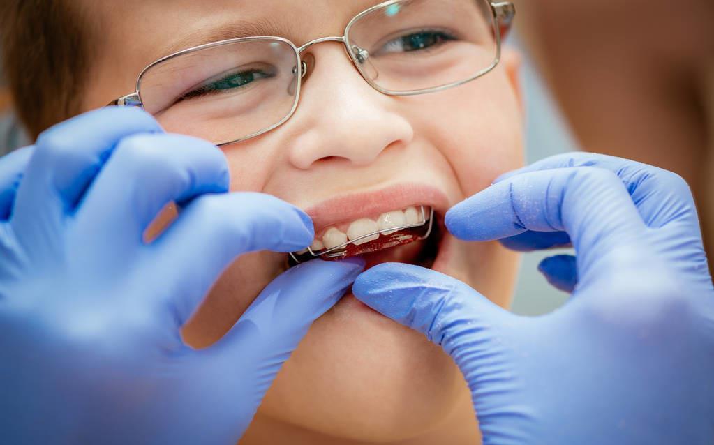 牙齿矫正|儿童做牙齿矫正三个最佳时间:家长要牢记,矫治越早干预效果越好