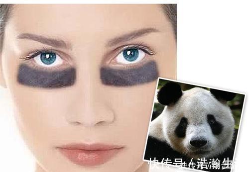 过敏性鼻炎|''熊猫眼''因为熬夜,还是肾虚?黑眼圈有三种类型,日常改善这么做