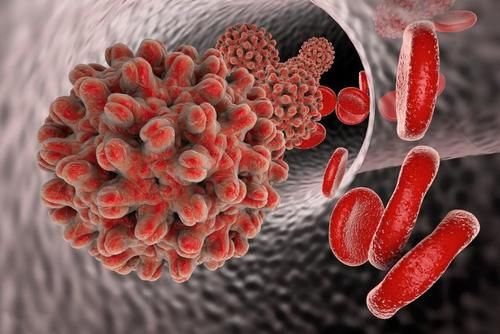 黄曲霉毒素|肝癌的高危人群有哪些?肝功能异常,或有9个征兆,别当成小问题