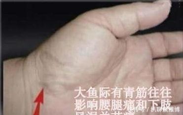 往提示|人体“青筋”凸起,反应身体的健康情况,越早看越好!