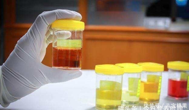 早上|早上起床后出现4种现象,你可能得考虑戒酒了