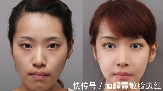 吴昕|最低调的眼霜突然就火了,一天卖出上千只,用后的黑眼圈都消失了!